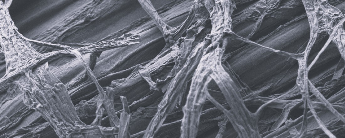 Mycelium of a fungus - scanning electron microscopy
